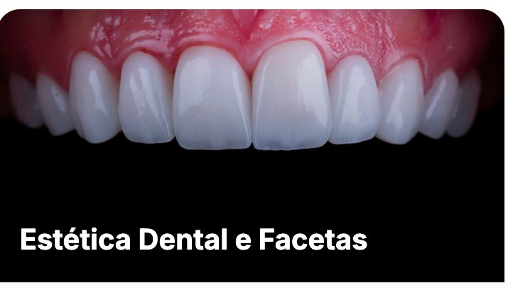 Clareamento dental em Guarulhos